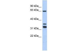 S100PBP antibody used at 1 ug/ml to detect target protein. (S100PBP 抗体  (Middle Region))