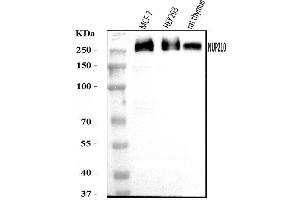 Western blot analysis of GP210/NUP210 using anti-GP210/NUP210 antibody (ABIN7600707). (NUP210 抗体  (AA 221-1724))