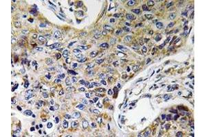 Immunohistochemistry (Paraffin-embedded Sections) (IHC (p)) image for anti-ATP Synthase, H+ Transporting, Mitochondrial Fo Complex, Subunit J2 (ATP5J2) (Subunit F) antibody (ABIN498517)