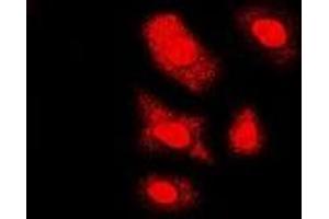 Immunofluorescent analysis of FKBP6 staining in U2OS cells. (FKBP6 抗体)