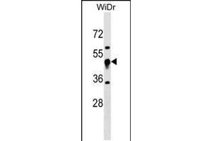 Western blot analysis in WiDr cell line lysates (35ug/lane). (UQCRC1 抗体  (N-Term))
