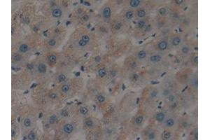 Detection of tPA in Human Liver Tissue using Polyclonal Antibody to Tissue Plasminogen Activator (tPA) (PLAT 抗体)