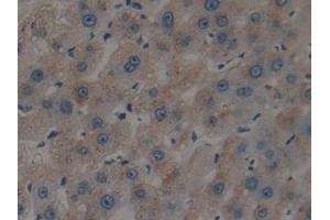 Detection of tPA in Human Liver Tissue using Polyclonal Antibody to Tissue Plasminogen Activator (tPA) (PLAT 抗体)