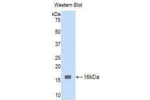 Western Blotting (WB) image for anti-Tumor Necrosis Factor Receptor Superfamily, Member 19 (TNFRSF19) (AA 41-161) antibody (ABIN1176207) (TNFRSF19 抗体  (AA 41-161))