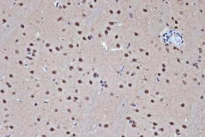 Immunohistochemistry (IHC) image for anti-Histone Deacetylase 8 (HDAC8) antibody (ABIN7267714)