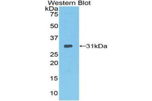 Western blot analysis of the recombinant protein. (Neurotrypsin 抗体  (AA 153-399))