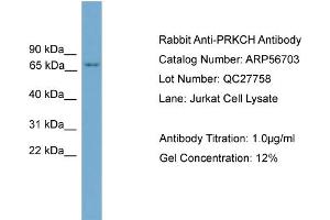 Western Blotting (WB) image for anti-Protein Kinase C, eta (PRKCH) (N-Term) antibody (ABIN2786852) (PKC eta 抗体  (N-Term))