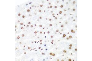 Immunohistochemistry of paraffin-embedded mouse liver using AGO2 antibody at dilution of 1:100 (40x lens). (AGO2 抗体)