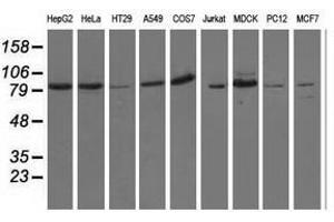 Image no. 2 for anti-Oxysterol Binding Protein-Like 11 (OSBPL11) antibody (ABIN1499923) (OSBPL11 抗体)