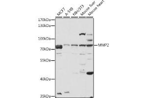 Western blot analysis of extracts of various cell lines, using MMP2 antibody (ABIN6129300, ABIN6143910, ABIN6143912 and ABIN6215078) at 1:3000 dilution. (MMP2 抗体  (AA 40-280))
