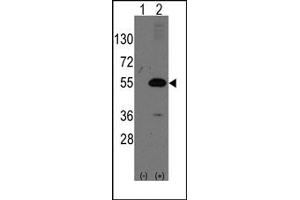 Image no. 1 for anti-Nuclear Receptor Subfamily 0, Group B, Member 1 (NR0B1) (N-Term) antibody (ABIN357833) (NR0B1 抗体  (N-Term))
