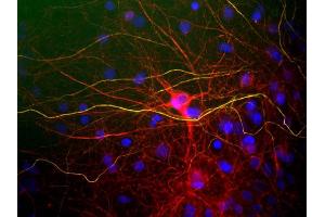 View of mixed neuron/glial cultures stained with NF-L / NEFL antibody (red) and rabbit antibody to phosphorylated NF-H (green). (NEFL 抗体)