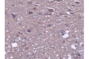 DAB staining on IHC-P; Samples: Rat Spinal cord Tissue (MTUS1 抗体  (AA 1-196))