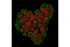 Immunofluorescence staining of MCF-7 cells using CD47 Mouse Monoclonal Antibody (IAP/3019) followed by goat anti-Mouse IgG conjugated to CF488 (green).