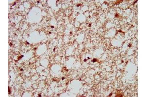 IHC image of ABIN7150649 diluted at 1:200 and staining in paraffin-embedded human brain tissue performed on a Leica BondTM system. (DSCAM 抗体  (AA 1711-1867))