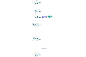 Image no. 1 for Zinc Finger Protein 101 (ZNF101) (AA 1-316) protein (GST tag) (ABIN1325859) (ZNF101 Protein (AA 1-316) (GST tag))