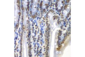 Immunohistochemistry of paraffin-embedded mouse Intestine using SEPT7 antibody (ABIN5971967) at dilution of 1/100 (40x lens). (Septin 7 抗体)