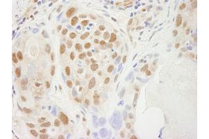 Immunohistochemistry (IHC) image for anti-Transcription Elongation Factor SPT5 (SUPT5H) (C-Term) antibody (ABIN7448819) (SUPT5H 抗体  (C-Term))