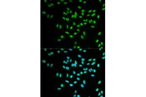 Immunofluorescence analysis of MCF-7 cells using FANCD2 antibody. (FANCD2 抗体  (AA 1-230))