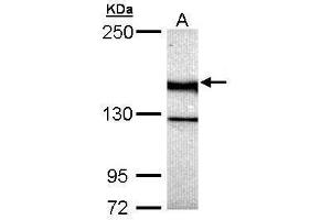 WB Image Sample (30 ug of whole cell lysate) A: Hela 5% SDS PAGE antibody diluted at 1:5000 (UNC13B 抗体  (Center))