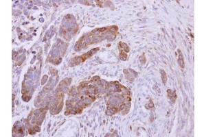 Immunohistochemistry (IHC) image for anti-NADH Dehydrogenase (Ubiquinone) Fe-S Protein 1, 75kDa (NADH-Coenzyme Q Reductase) (NDUFS1) (Center) antibody (ABIN2856074)