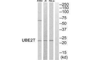 Western blot analysis of extracts from HeLa cells, Jurkat cells and K562 cells, using UBE2T antibody. (Ube2t 抗体  (Internal Region))