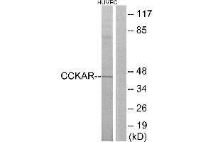 Western blot analysis of extracts from HUVEC cells, using CCKAR antibody. (CCKAR 抗体  (Internal Region))