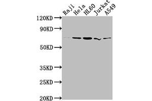 Western Blot Positive WB detected in: Raji whole cell lysate, Hela whole cell lysate, HL60 whole cell lysate, Jurkat whole cell lysate, A549 whole cell lysate All lanes: PRMT5 antibody at 1:2000 Secondary Goat polyclonal to rabbit IgG at 1/50000 dilution Predicted band size: 73, 72, 54, 68, 67 kDa Observed band size: 73 kDa (Recombinant PRMT5 抗体)