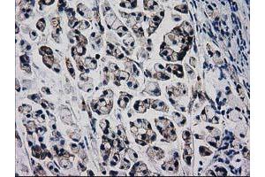 Image no. 3 for anti-Catenin (Cadherin-Associated Protein), beta 1, 88kDa (CTNNB1) antibody (ABIN1496890) (CTNNB1 抗体)