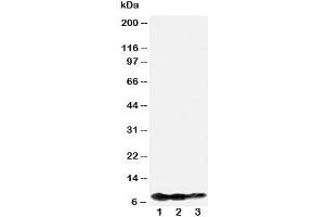Western blot testing of BAFF-R antibody and Lane 1:  recombinant human protein 10ng;  2: 5ng;  3: 2. (TNFRSF13C 抗体  (N-Term))
