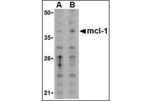 Western blot analysis of Mcl-1in Raji cell lysates with this product at (A) 1 and (B) 2 μg/ml. (MCL-1 抗体  (N-Term))