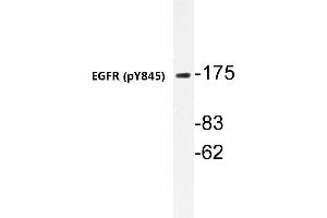 Western blot (WB) analyzes of p-EGFR antibody in extracts from A431 cells. (EGFR 抗体  (pTyr869))
