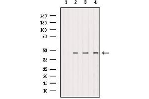 Western blot analysis of extracts from various samples, using MEK2 Antibody.