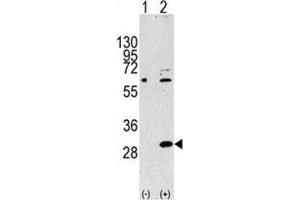 Western blot analysis of EIF4E2 antibody and 293 cell lysate either nontransfected (Lane 1) or transiently transfected with the EIF4E2 gene (2). (EIF4E2 抗体  (AA 12-41))