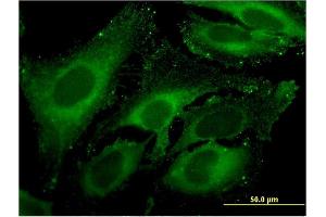 Immunofluorescence of monoclonal antibody to CPA4 on HeLa cell. (CPA4 抗体  (AA 260-361))