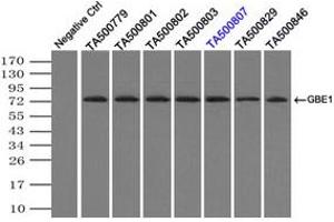 Image no. 1 for anti-Glucan (1,4-alpha-), Branching Enzyme 1 (GBE1) antibody (ABIN1498395) (GBE1 抗体)