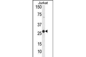 Western blot analysis of C Antibody (Center) (ABIN653826 and ABIN2843094) in Jurkat cell line lysates (35 μg/lane). (CD160 抗体  (AA 56-82))