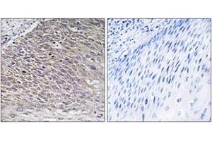 Immunohistochemistry analysis of paraffin-embedded human testis tissue, using MAST4 Antibody. (MAST4 抗体  (AA 251-300))