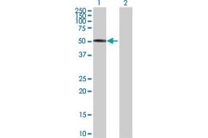 Western Blotting (WB) image for FOXA2 293T Cell Transient Overexpression Lysate(Denatured) (ABIN1332168)