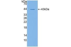 Detection of Recombinant CD19, Human using Polyclonal Antibody to Cluster Of Differentiation 19 (CD19)