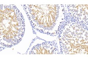 Detection of HSPA1L in Rat Testis Tissue using Polyclonal Antibody to Heat Shock 70 kDa Protein 1 Like Protein (HSPA1L) (HSPA1L 抗体  (AA 1-641))