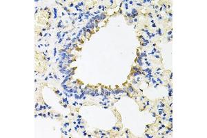 Immunohistochemistry (IHC) image for anti-Calumenin (CALU) (AA 20-315) antibody (ABIN6137878)