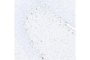 Immunohistochemistry (IHC) image for anti-Achaete-Scute Complex Homolog 1 (Drosophila) (ASCL1) (AA 186-236) antibody (ABIN7455113)