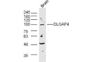 Rat brain lysates probed with SAPAP4/DLGAP4 Polyclonal Antibody, unconjugated  at 1:300 overnight at 4°C followed by a conjugated secondary antibody at 1:10000 for 90 minutes at 37°C. (DLGAP4 抗体  (AA 261-370))
