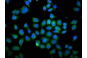 Immunofluorescence staining of Hela cells with ABIN7149579 at 1:66, counter-stained with DAPI. (DOCK1 抗体  (AA 1676-1865))