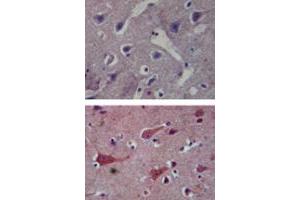 Immunohistochemical analysis of TLR8 in paraffin-embedded formalin-fixed human brain tissue using an isotype control (top) and TLR8 monoclonal antibody, clone 44C143  (bottom) at 5 ug/mL . (TLR8 抗体  (AA 750-850))