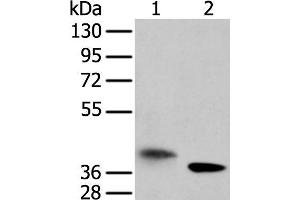 Western blot analysis of A172 cell and mouse kidney tissue using LRRC19 Polyclonal Antibody at dilution of 1:450 (LRRC19 抗体)