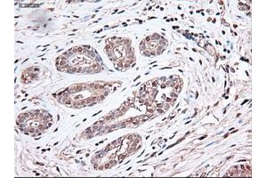 Immunohistochemical staining of paraffin-embedded breast using anti-Trim33 (ABIN2452535) mouse monoclonal antibody. (TRIM33 抗体  (AA 887-1046))