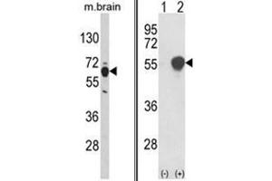 (LEFT) Western blot analysis of PHGDH Antibody (N-term) in mouse brain tissue lysates (35ug/lane). (PHGDH 抗体  (N-Term))