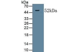 Detection of Recombinant COL5a2, Human using Monoclonal Antibody to Collagen Type V Alpha 2 (COL5a2) (COL5A2 抗体  (AA 82-308))
